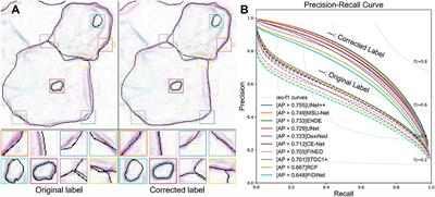 Local Label Point Correction for Edge Detection of Overlapping Cervical Cells